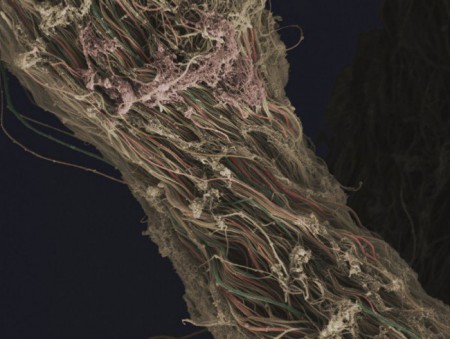 Волокно сполучної тканини