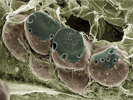 Адипоциты ( клетки жировой ткани)