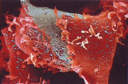 разрыв клеточной мембраны и выход вирусных частиц