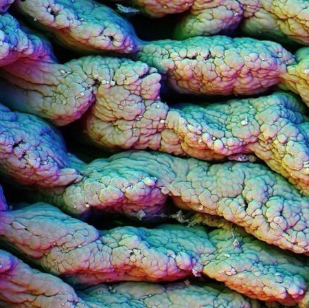 ворсинки тонкой кишки