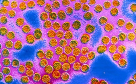 Вирус папилломы, который является причиной возникновения бородавок.