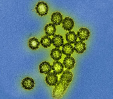 Вирус гриппа H1N1, штамм А этого гриппа в 2009 году стал известен как «свиной грипп».