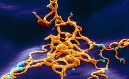 Бактерия спирохеты (#Borrelia_burgdorferi), способная вызывать болезнь Лайма у человека после укуса клеща.